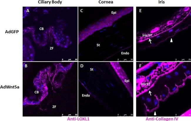 Collagen IV Antibody in Immunohistochemistry (IHC)