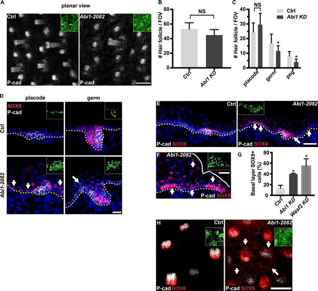 P-cadherin Antibody in Immunohistochemistry (IHC)