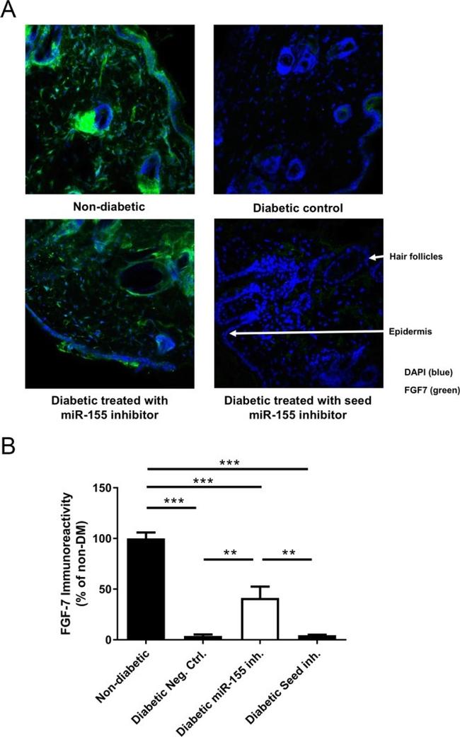 KGF Antibody in Immunohistochemistry (IHC)