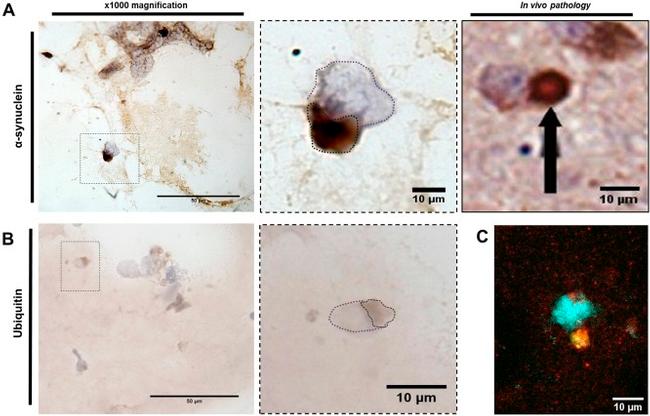 alpha Synuclein Antibody in Immunohistochemistry (IHC)