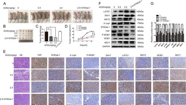 YAP1 Antibody in Immunohistochemistry (IHC)