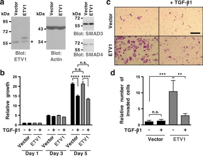 SMAD3 Antibody in Western Blot (WB)