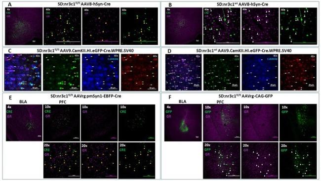 Glucocorticoid Receptor Antibody in Immunohistochemistry (IHC)