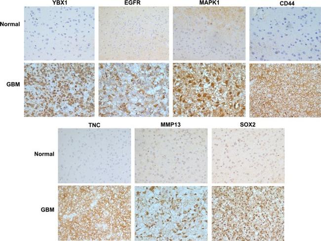 SOX2 Antibody in Immunohistochemistry (IHC)