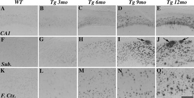 beta Amyloid Antibody in Immunohistochemistry (IHC)