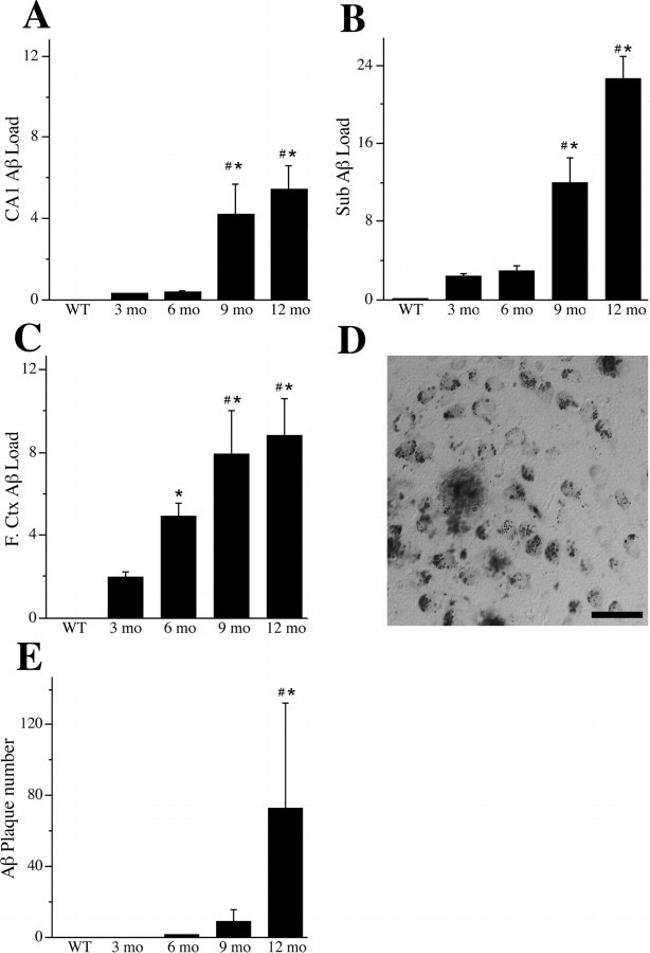 beta Amyloid Antibody in Immunohistochemistry (IHC)