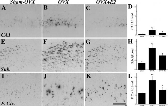 beta Amyloid Antibody in Immunohistochemistry (IHC)