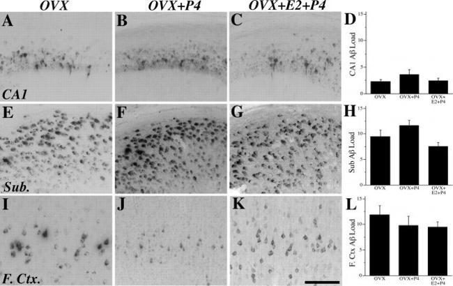 beta Amyloid Antibody in Immunohistochemistry (IHC)