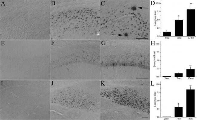 beta Amyloid Antibody in Immunohistochemistry, Immunohistochemistry - Free Floating (IHC, IHC (Free))