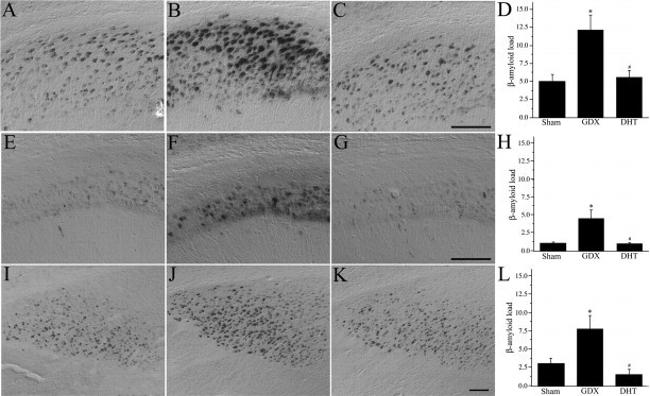 beta Amyloid Antibody in Immunohistochemistry, Immunohistochemistry - Free Floating (IHC, IHC (Free))