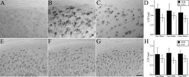 beta Amyloid Antibody in Immunohistochemistry, Immunohistochemistry - Free Floating (IHC, IHC (Free))