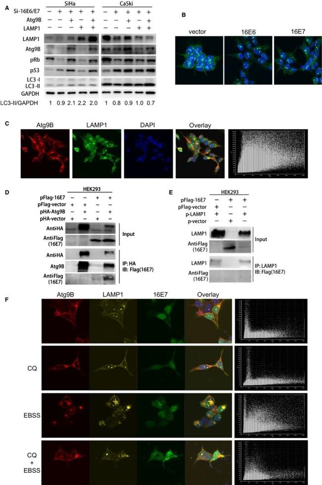 ATG9B Antibody in Western Blot, Immunocytochemistry (WB, ICC/IF)