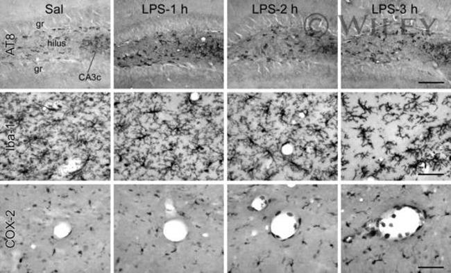 Phospho-Tau (Ser202, Thr205) Antibody in Immunohistochemistry (IHC)