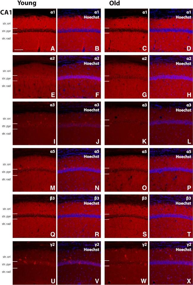 GABRA5 Antibody in Immunohistochemistry (IHC)