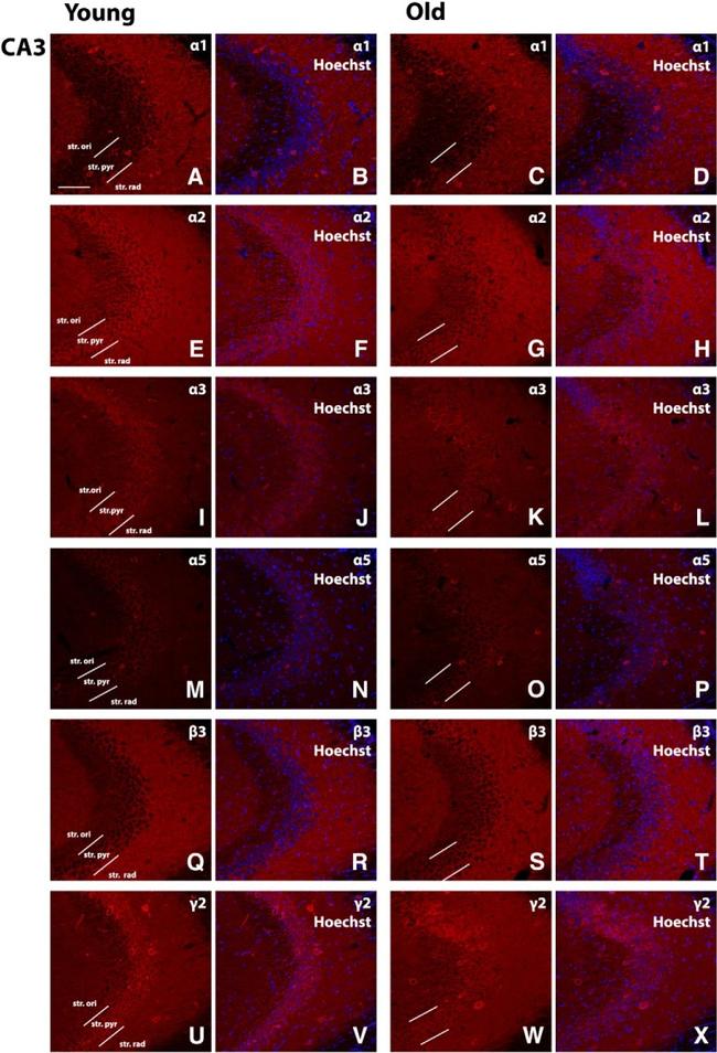 GABRA5 Antibody in Immunohistochemistry (IHC)