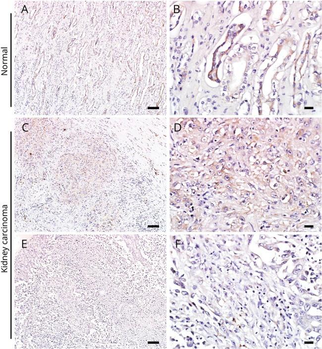 PDE10A Antibody in Immunohistochemistry (IHC)