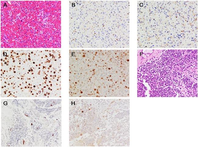 Creatine Kinase MB Antibody in Immunohistochemistry (IHC)