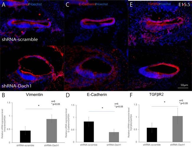 TGFBR2 Antibody in Immunocytochemistry (ICC/IF)