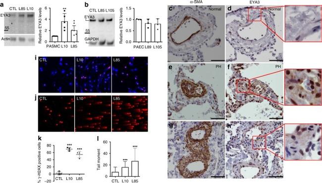 Alpha-Smooth Muscle Actin Antibody in Immunohistochemistry (IHC)