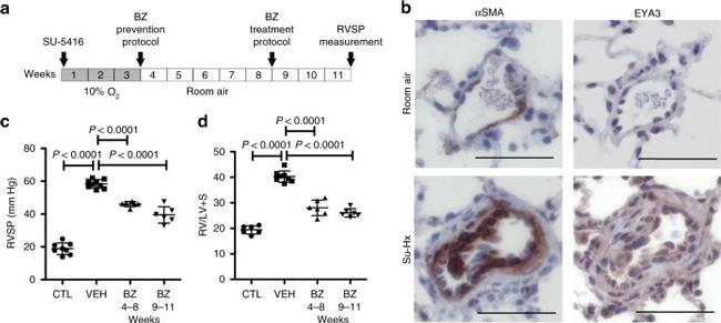 Alpha-Smooth Muscle Actin Antibody in Immunohistochemistry (IHC)