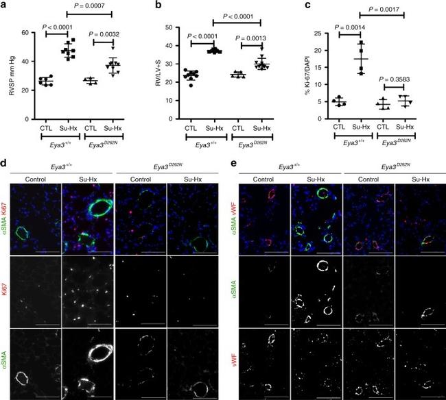 Alpha-Smooth Muscle Actin Antibody in Immunocytochemistry (ICC/IF)