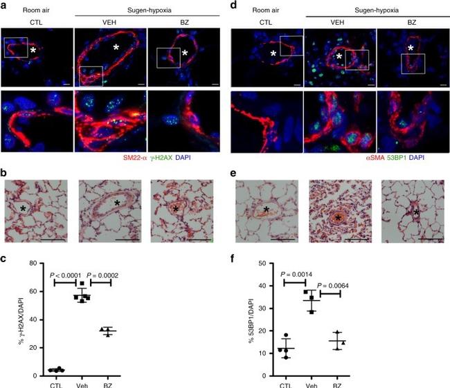 Alpha-Smooth Muscle Actin Antibody in Immunocytochemistry, Immunohistochemistry (ICC/IF, IHC)