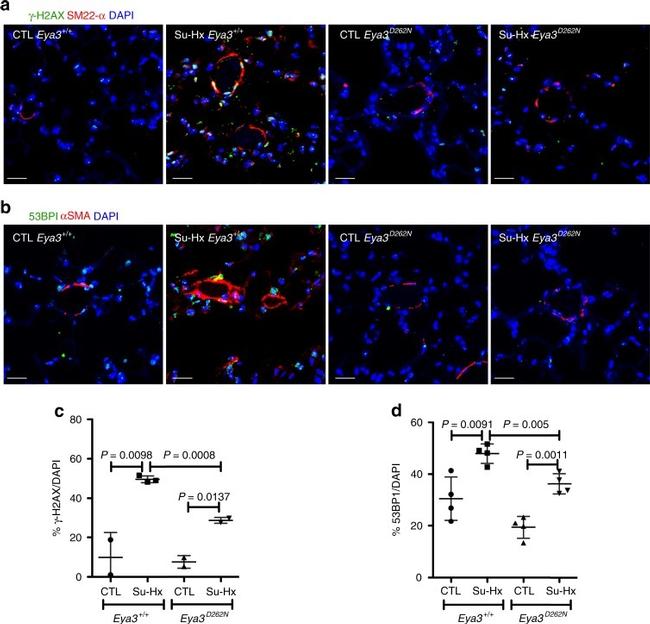 Alpha-Smooth Muscle Actin Antibody in Immunocytochemistry (ICC/IF)