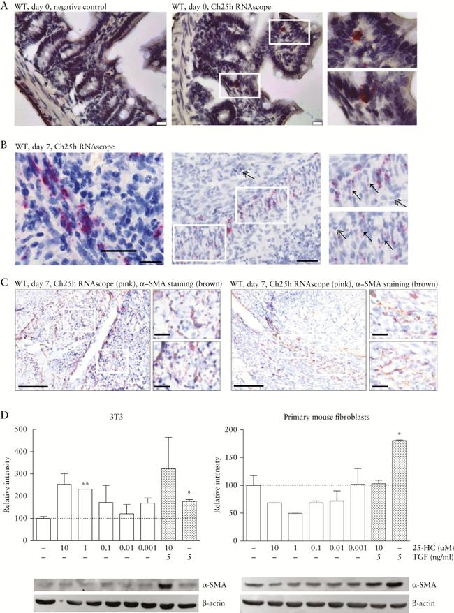 Alpha-Smooth Muscle Actin Antibody in Western Blot (WB)