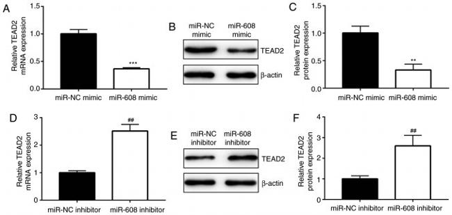 TEAD2 Antibody in Western Blot (WB)