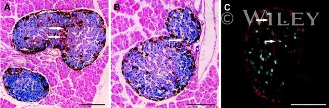 beta Galactosidase Antibody in Immunohistochemistry (IHC)