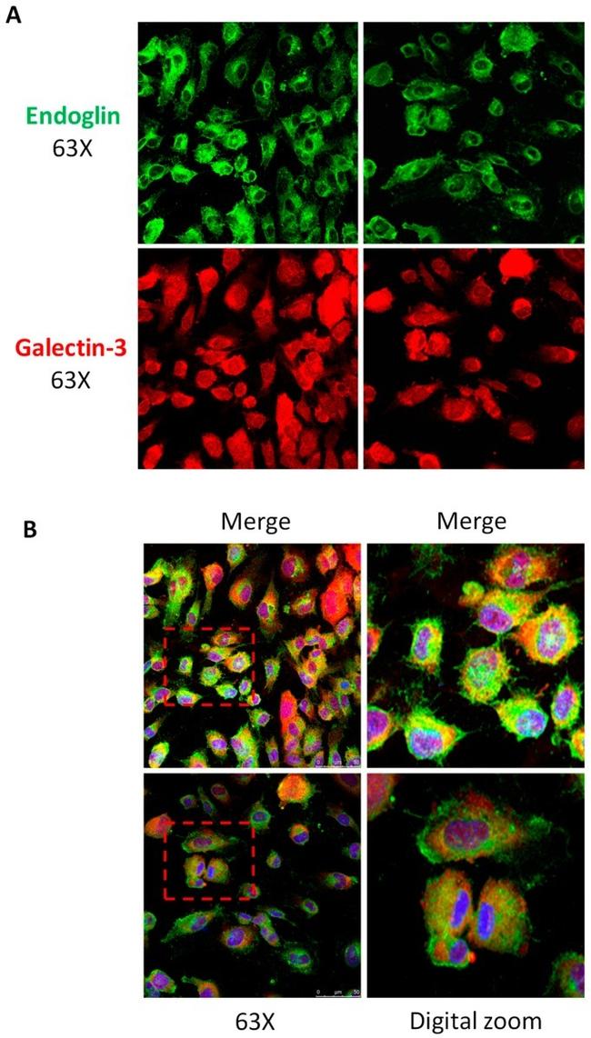 Galectin 3 Antibody in Immunocytochemistry (ICC/IF)