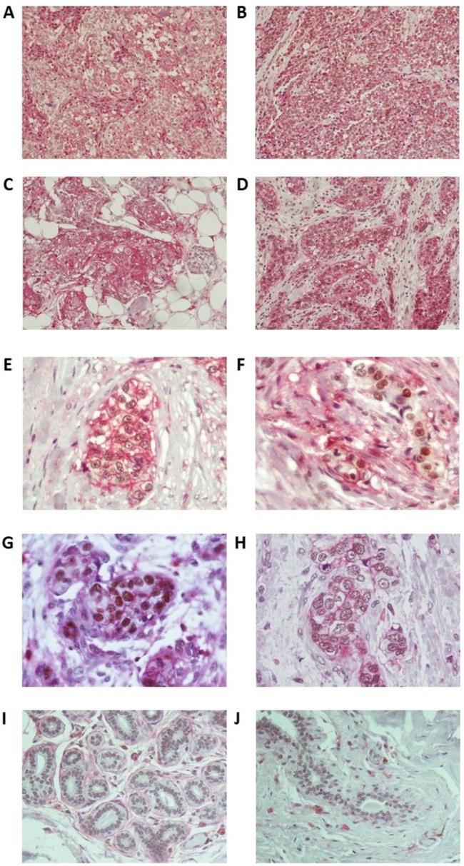 CD44 Antibody in Immunohistochemistry (IHC)