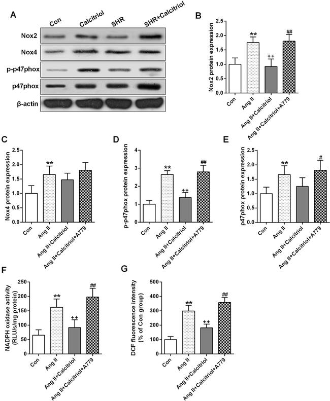 Phospho-p47phox (Ser370) Antibody in Western Blot (WB)