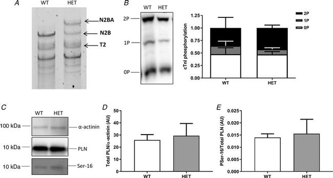 Cardiac Troponin I Antibody in Western Blot (WB)