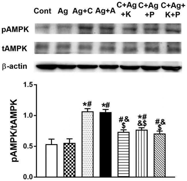 Phospho-AMPK alpha-1,2 (Thr183, Thr172) Antibody in Western Blot (WB)