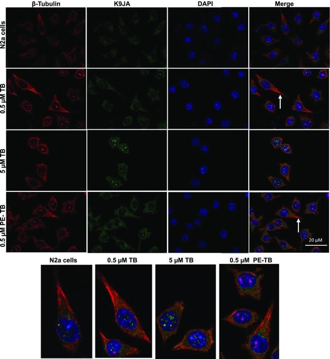 beta Tubulin Antibody in Immunocytochemistry (ICC/IF)