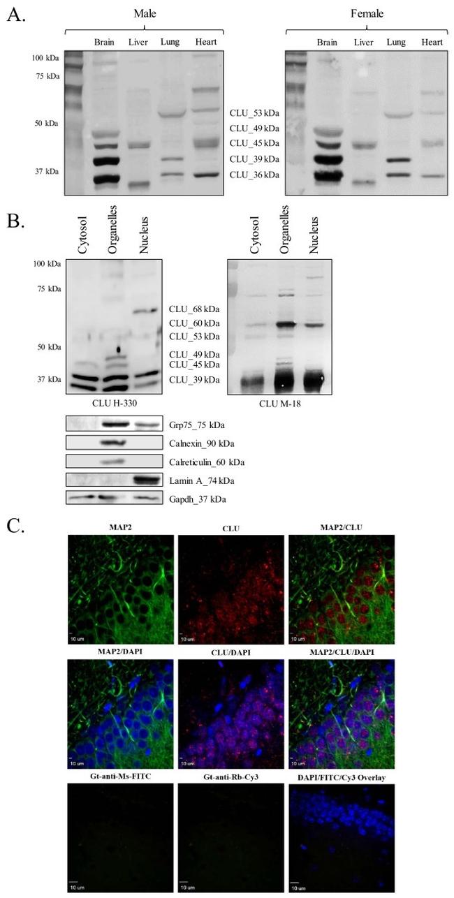 MAP2 Antibody in Immunohistochemistry (IHC)