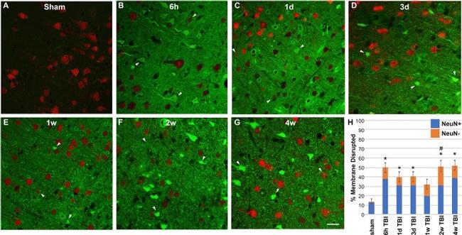 Alexa Fluor 488 Antibody in Immunohistochemistry (IHC)