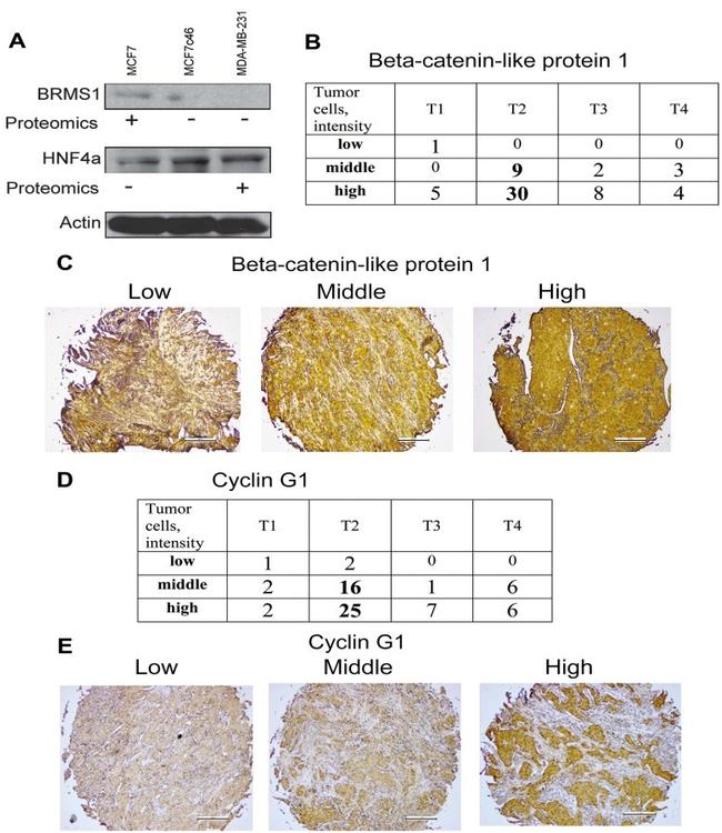 CTNNBL1 Antibody in Immunohistochemistry (IHC)