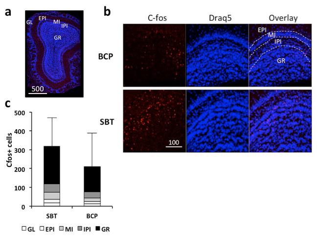 c-Fos Antibody in Immunohistochemistry (IHC)