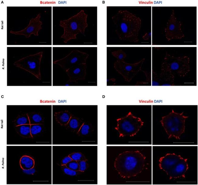 beta Catenin Antibody in Immunocytochemistry (ICC/IF)