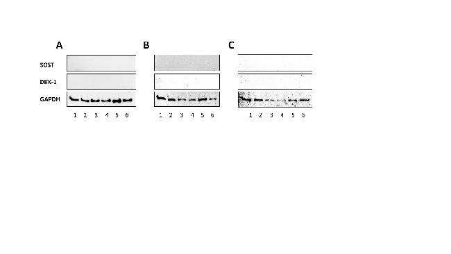 DKK1 Antibody in Western Blot (WB)