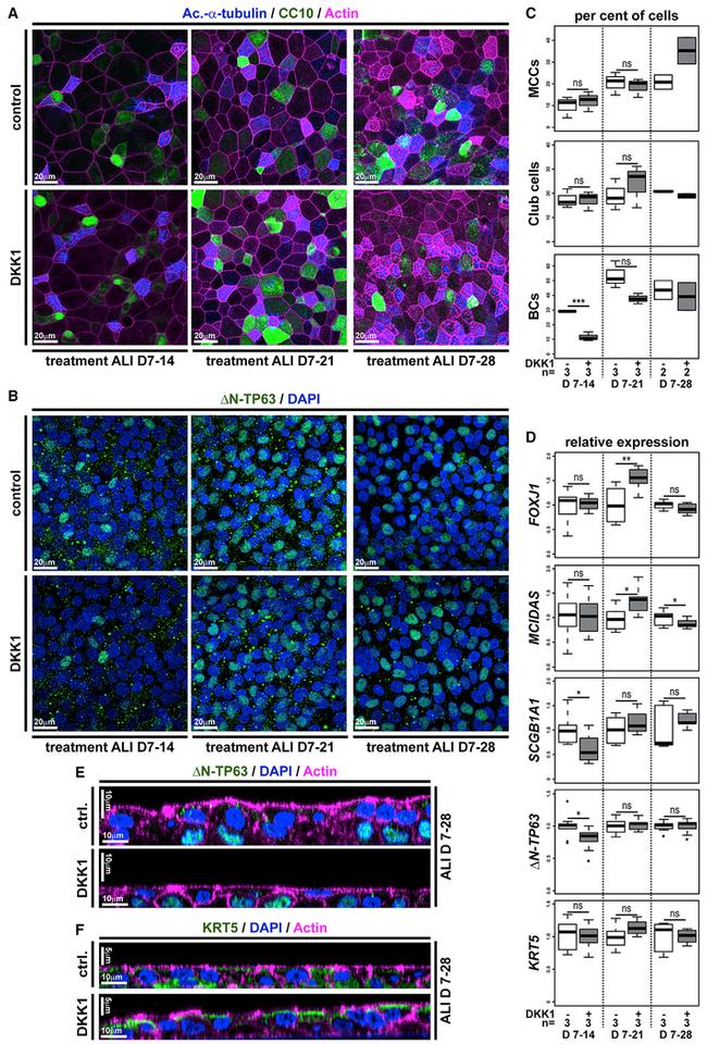 Cytokeratin 5 Antibody in Immunocytochemistry (ICC/IF)