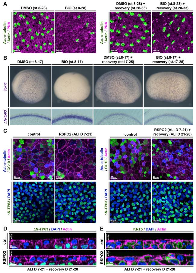 Cytokeratin 5 Antibody in Immunocytochemistry (ICC/IF)