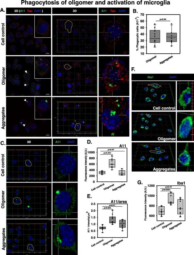 Tau Antibody in Immunocytochemistry (ICC/IF)