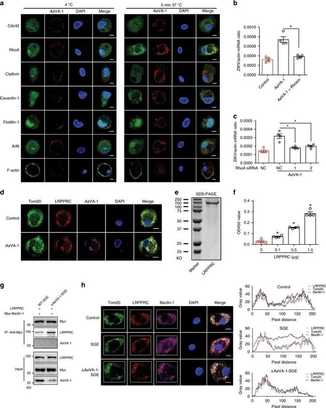 ARF6 Antibody in Immunocytochemistry (ICC/IF)