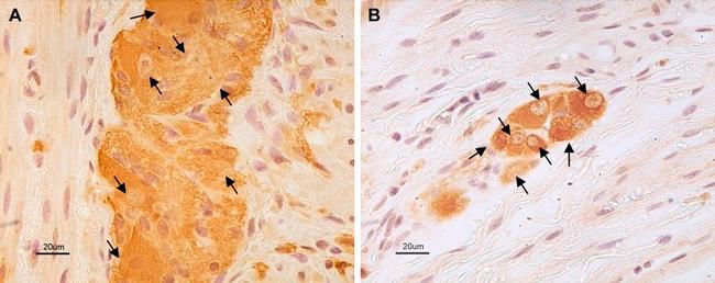 NSE Antibody in Immunohistochemistry (IHC)