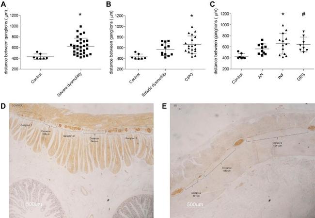 NSE Antibody in Immunohistochemistry (IHC)