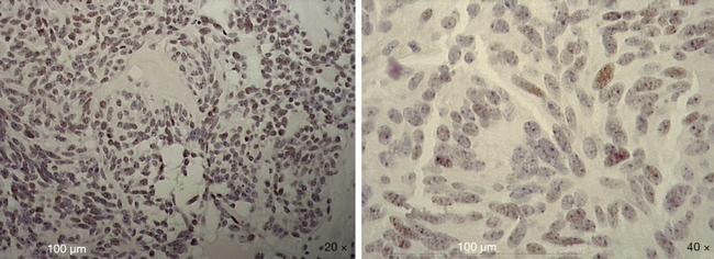 SOX2 Antibody in Immunohistochemistry (IHC)