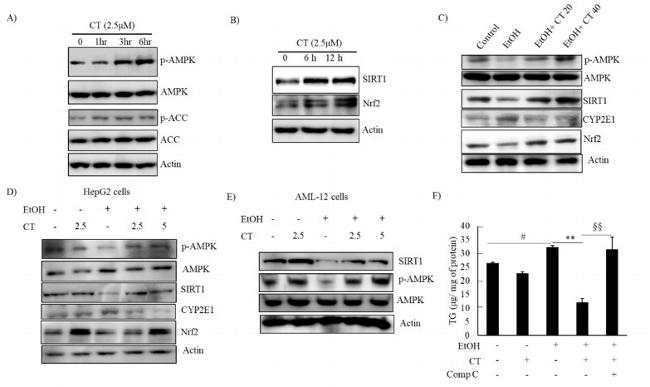 Phospho-AMPK alpha-1,2 (Thr183, Thr172) Antibody in Western Blot (WB)